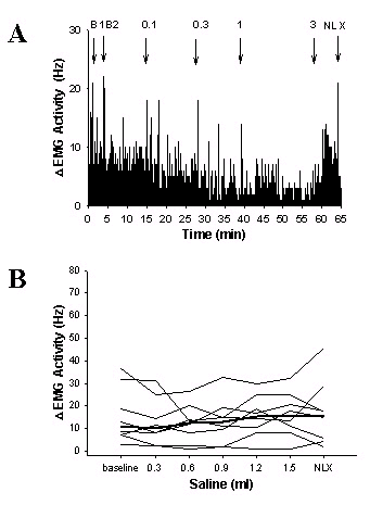 A represents a printout of a typical EMG trace
